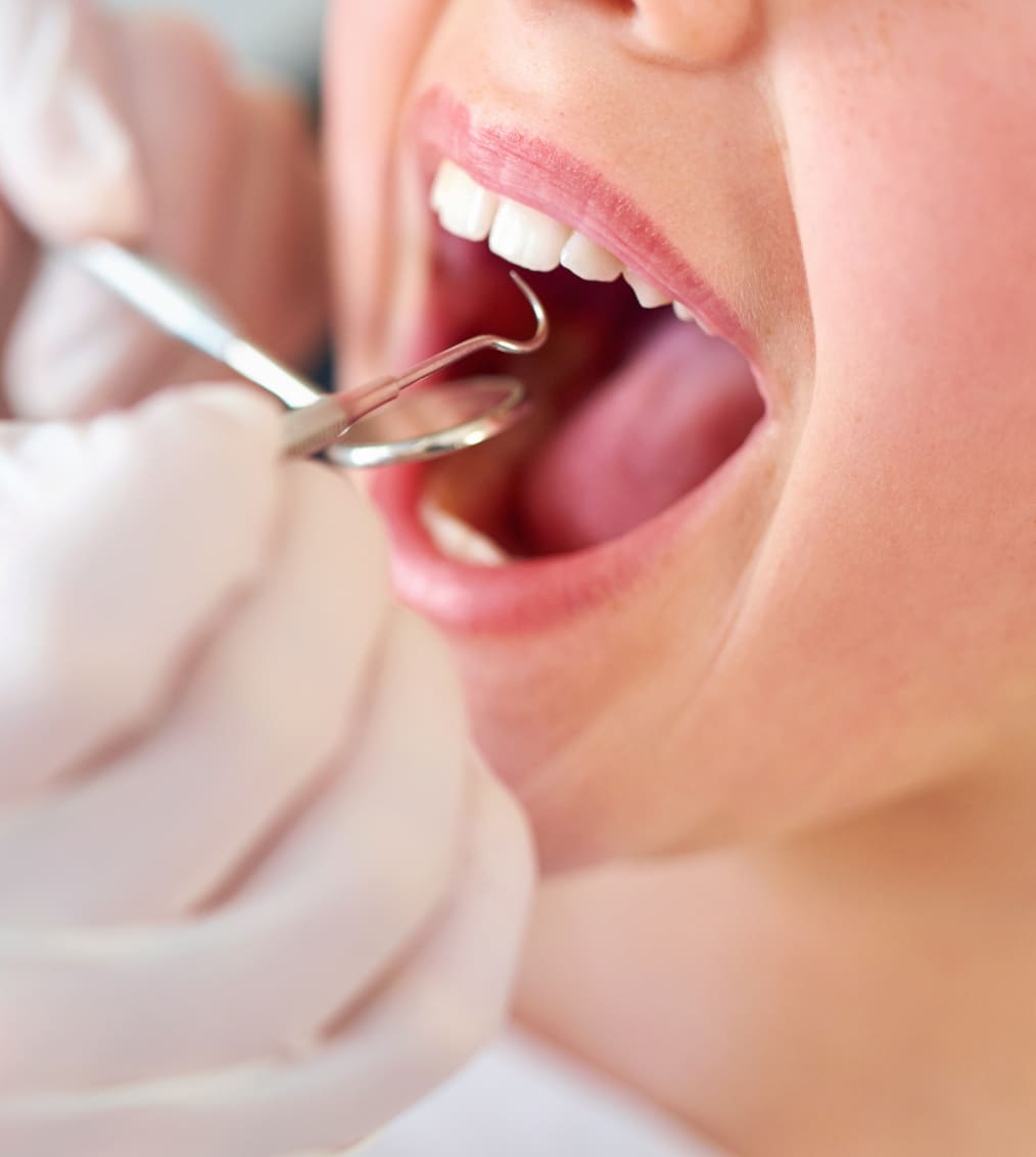 Pourquoi un bilan parodontal est l'étape essentielle — Parodontologie à Chenoise-Cucharmoy
