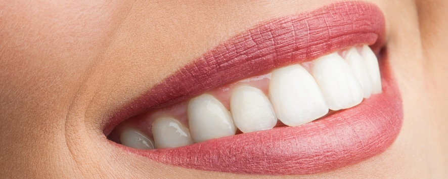 L'examen de votre bouche et l'évaluation du réalisable — Facettes dentaires à Esternay